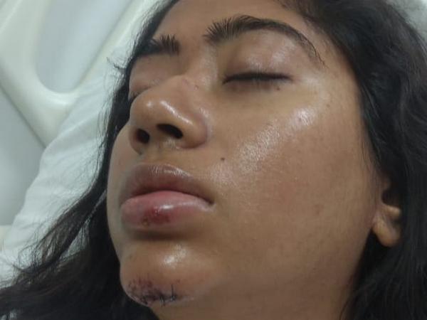 Joymala Bagchi being treated for her injuries at AIIMS New Delhi. Photo/ANI