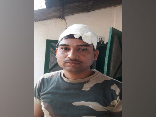 Constable G Sarwan, who was injured in an attack by miscreants on February 27.