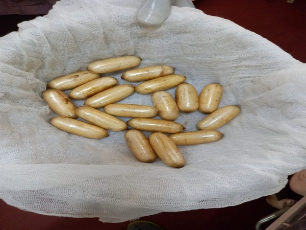 Cocaine capsules seized from the two Tanzanian nationals (Photo/ANI) 