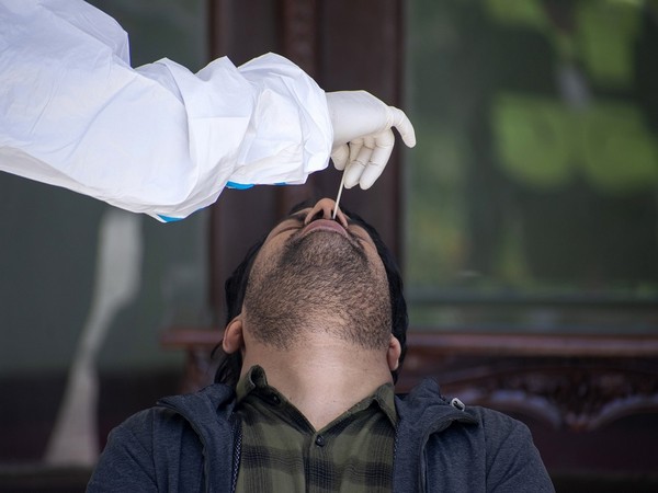 Representative image