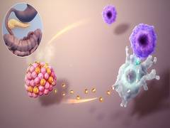 
      
      Genetic differences distinguish Children's type 1 diabetes...
      
      