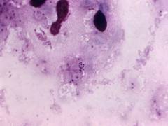 
      
      Here's how immune system kills bacteria
      
      
