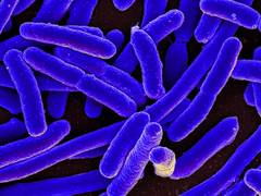 
      
      Bacteria can 'outsmart' programmed cell death: Study
      
      