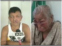 
      
      BJP worker alleges TMC workers of brutally attacking him,...
      
      