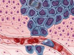
      
      Scientists can now listen to cancer cells after new study
      
      
