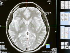 
      
      Scientists discover new brain cells responsible for...
      
      