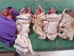 
      
      Woman gives birth to quintuplets in UP's Barabanki 
      
      