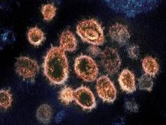 
      
      Coronavirus survey reveals WHO faces credibility crisis among...
      
      