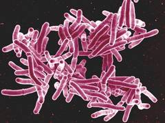 
      
      Study finds surprising new way on how tuberculosis suppresses...
      
      
