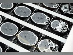 
      
      Brain scans reveal the hidden shape of thinking
      
      
