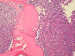 
      
      Scientists discover new approach to treating incurable...
      
      