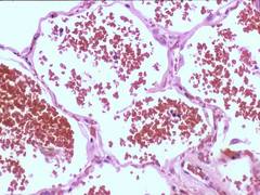 
      
      Scientists find technique to prevent deaths due to postpartum...
      
      