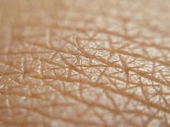
      
      Skin infections can cause rheumatic fever: Study
      
      