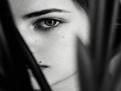 
      
      Study finds why moles become melanomas
      
      