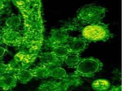 
      
      COVID-19 vaccine activates antibodies that target parts of...
      
      