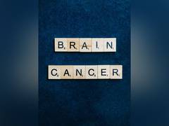 
      
      Research finds reason for return of brain cancer
      
      