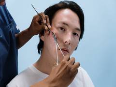 
      
      Microneedling improves appearance of surgical scars
      
      