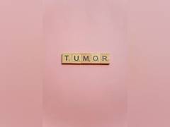 
      
      Artificial intelligence can be trained to detect tumour
      
      