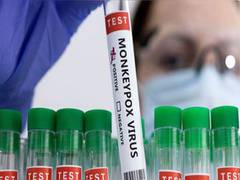 
      
      Oral, Nasal samples critical for Monkeypox diagnosis, ICMR study
      
      