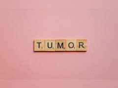 
      
      Scientists discover new device to measure changing size of tumors
      
      