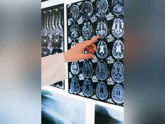 
      
      Exploring mechanisms underlying consciousness problems
      
      
