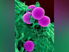 
      
      Study sheds light on blood cells' precancerous 'clonal expansion'
      
      