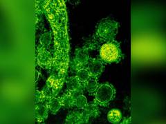 
      
      Researchers suggest metals may help to fight fungal infections 
      
      