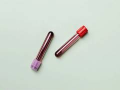 
      
      Blood tests may help detect who may get long Covid: Study
      
      