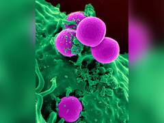 
      
      The hepatitis B-neutralizing cell sentinel
      
      