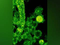 
      
      Immunologic defect may leave vulnerable to bacterial infection
      
      