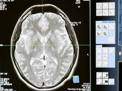 
      
      Study reveals cerebellum is important for survival
      
      