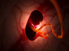 
      
      Impact of social disadvantages on fetal brain development
      
      