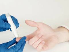 
      
      People who have diabetes more ofte affected by trigger finger
      
      