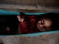 
      
      Children in flood-affected areas of Pak suffering malnutrition
      
      