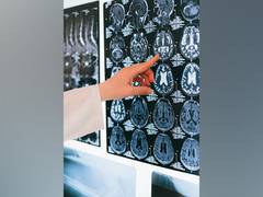 
      
      Word and face recognition can be supported with half a brain
      
      