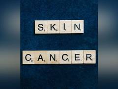 
      
      Melanoma survivors might be identified using an AI technique
      
      