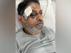 
      
      Congress leader Nitin Raut injured during Bharat Jodo Yatra
      
      