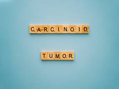 
      
      Study finds level of copper in tumour cells
      
      