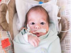 
      
      'Skin-to-skin contact for babies born prematurely needed'
      
      