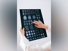 
      
      Study suggest how MRI shows brain changes in patina post-COVID
      
      