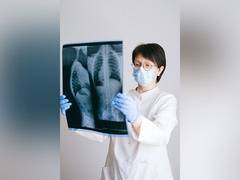 
      
       Lung cancer screening helps to increase survival rate of cancer 
      
      