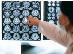 
      
      Biomarkers of attention deficit hyperactivity disorder in kids
      
      