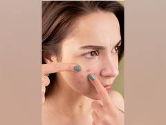 
      
      Treating acne with systemic antibiotics: Risks
      
      
