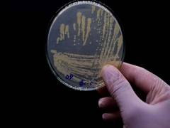 
      
      New research reveals relationship between oral bacteria, diseases
      
      