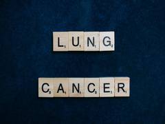 
      
      Carbon ultrafine particles accelerate lung cancer progression
      
      