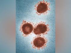 
      
      48,500 year old zombie virus revived by scientists in Russia
      
      