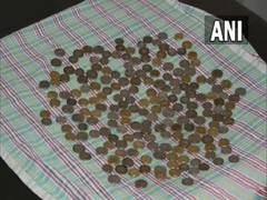 
      
      Doctors remove 187 coins from man's stomach
      
      
