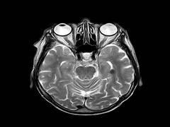
      
      Researchers show organoids respond to external sensory stimuli
      
      