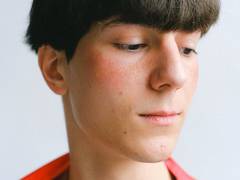 
      
      Study reveals mechanism of fat cells in skin which fight pimples 
      
      