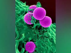 
      
      Overactive cell metabolism linked to biological ageing
      
      